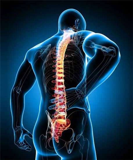 Radiculopathy